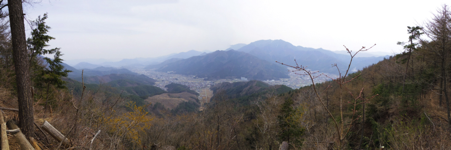 �V�q�R��a����̕x�m�݂�